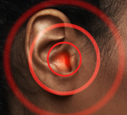 Điều trị chứng ù tai