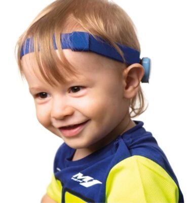 em bé đeo máy trợ thính đường xương