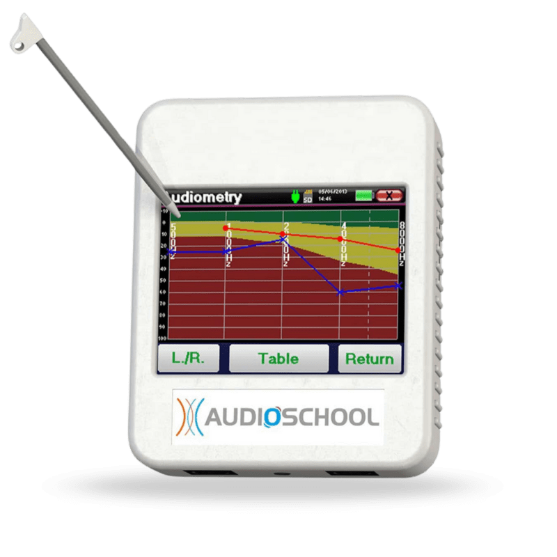 Máy đo sàng lọc Audioschool