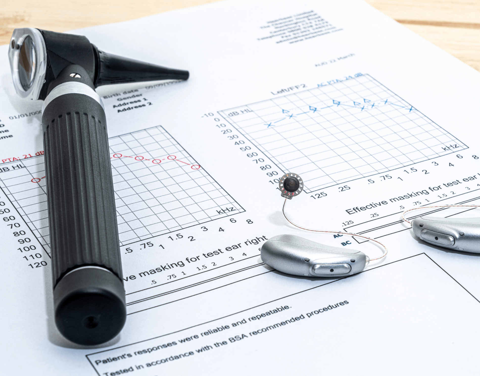 Hiểu rõ về bài kiểm tra soi tai