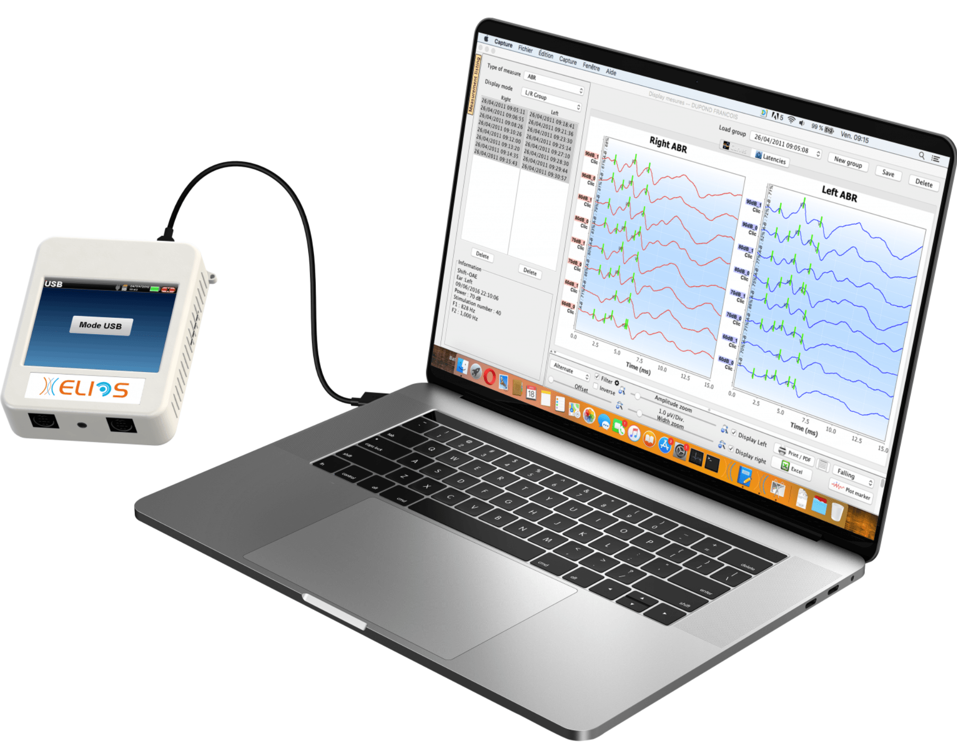 Kết quả chính xác cao